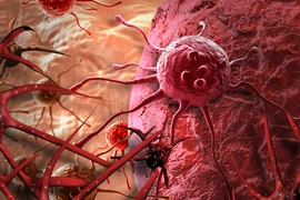 Chế tạo ra phân tử khiến tế bào ung thư tự hủy