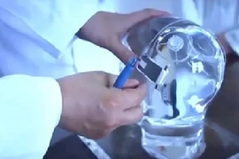 Thiết bị hỗ trợ điều trị cho bệnh nhân mắc chứng động kinh 