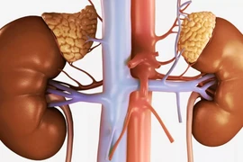 Người phụ nữ bị suy tuyến thượng thận: Bệnh nguy hiểm, phòng ngừa sao?