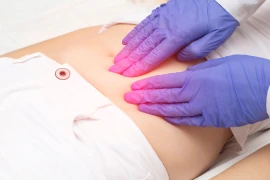 Triệu chứng của u nang buồng trứng bạn nên biết