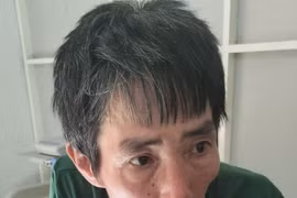 Thanh Hóa: Người đàn ông say xỉn dùng điếu cày đánh công an