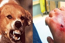 Người phụ nữ 67 tuổi tử vong sau 6 tháng bị chó nhà cắn