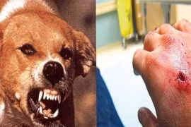 Người phụ nữ 67 tuổi tử vong sau 6 tháng bị chó nhà cắn