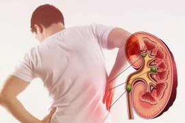 Chế độ ăn cho người suy thận 