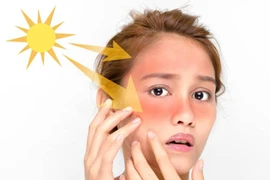 Thực phẩm giúp giảm thiểu tình trạng cháy nắng