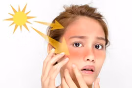 Thực phẩm giúp giảm thiểu tình trạng cháy nắng