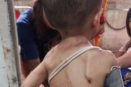 Diễn biến mới vụ bé trai 2 tuổi nghi bị bạo hành ở TPHCM