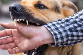 Đang chơi trước nhà, bé trai 3 tuổi bị chó dại cắn đứt nửa bên lưỡi