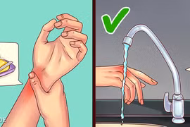 Những mẹo chữa bệnh có thể khiến bạn “lợn lành thành lợn què"