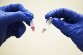 Phương pháp mới phát hiện ung thư chỉ trong 10 phút chính xác 90%