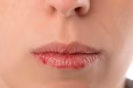 Nhìn miệng đoán bệnh