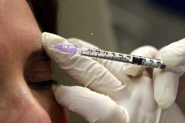 7 trường hợp tiêm botox chữa bệnh cực kỳ hiệu quả