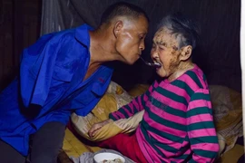 Ảnh đẹp mùa Vu Lan: Con cụt tay dùng miệng xúc cơm cho mẹ