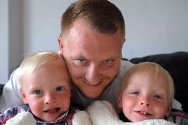 Kỳ lạ cặp sinh đôi có cơ quan nội tạng nằm đối lập nhau