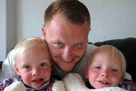 Kỳ lạ cặp sinh đôi có cơ quan nội tạng nằm đối lập nhau