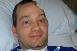 Kinh hãi tù nhân mất nửa đầu vì không được dùng kháng sinh