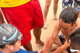 Bà Rịa - Vũng Tàu: Du khách bị cá đuối tấn công phải nhập viện