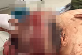  Đại úy công an ở Bình Phước bị kẻ gây rối chém trọng thương