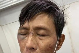 Hải Phòng: Bắt đối tượng vác rìu chém công an sau khi gây án