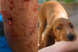 Liên tiếp nhiều vụ chó điên lao vào cắn chết người thương tâm 