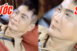 Sao nam gây bất ngờ khi phẫu thuật thẩm mỹ ở tuổi trung niên