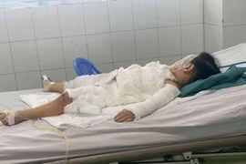 Tưởng chai nước ngọt bé 2 tuổi uống phải nước tẩy bồn cầu bỏng nặng