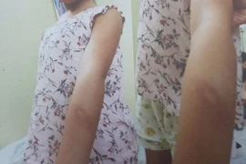 Hàng xóm không tố giác bạo hành có bị xử lý?