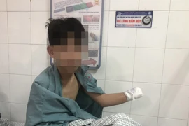 5 trường hợp tổn thương nặng nề do pháo Tết