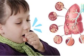 Nguyên nhân ho kéo dài ở trẻ cha mẹ cần biết để chữa kịp thời