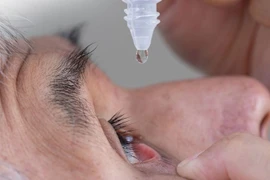 Đau mắt đỏ dùng thuốc gì?