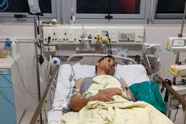 Tim phổi nhân tạo cứu bệnh nhân nhồi máu cơ tim, sốc tim, ngừng tuần hoàn