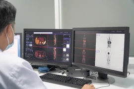 Bác sĩ đang theo dõi kết quả chụp PET/CT trên màn hình.