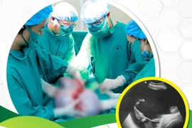 Đã cắt bán phần tử cung 30 năm vẫn bị u buồng trứng khổng lồ