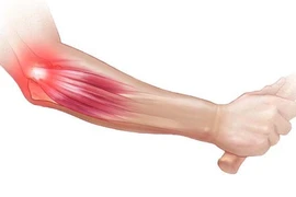 Phục hồi tay đau sau chơi tennis, cầu lông