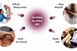 Bác sĩ chỉ rõ đường lây truyền của Virus HPV gây ung thư cổ tử cung
