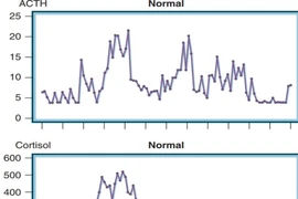 Ảnh: Dao động nồng độ Cortisol và ACTH trong ngày