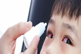 Liệu pháp 6 “KHÔNG” bảo vệ bản thân và gia đình không bị đau mắt đỏ