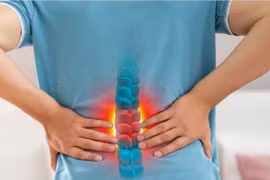 Chuyên gia mách giải pháp giảm đau hiệu quả cho chứng đau do xẹp đốt sống