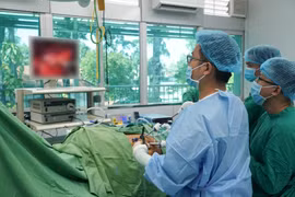 Nội soi thành công cho bệnh ung thư thận có chồi bướu trong tĩnh mạch chủ