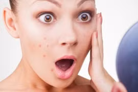 Loại bỏ sai lầm để da khỏe đẹp khi hè về