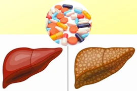 Địa chỉ vàng: Một số loại thực phẩm chức năng hỗ trợ gan nhiễm mỡ