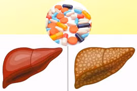 Địa chỉ vàng: Một số loại thực phẩm chức năng hỗ trợ gan nhiễm mỡ