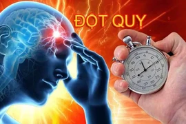 7 thói quen tốt giúp tăng lưu thông máu, phòng đột quỵ