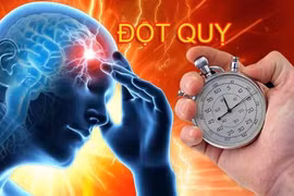 7 thói quen tốt giúp tăng lưu thông máu, phòng đột quỵ