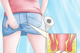 Nguy cơ bệnh nguy hiểm nếu chủ quan với ngứa hậu môn