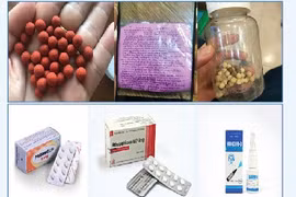 Tự dùng thuốc trị đau khớp bị biến chứng suy tuyến thượng thận nguy kịch