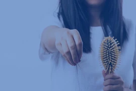 Vì sao người trẻ tuổi lại bị rụng tóc nhiều?