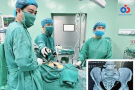 2 người bị dụng cụ tránh thai xuyên thủng ruột