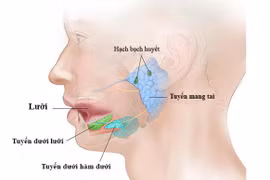 Cách khắc phục viêm tuyến nước bọt khi điều trị ung thư tuyến giáp