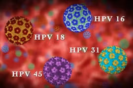 Bác sĩ chỉ rõ dương tính HPV có phải mắc ung thư cổ tử cung?